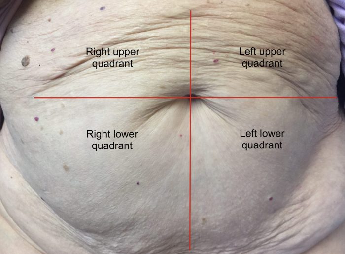 Abdominal assessment hesi case study