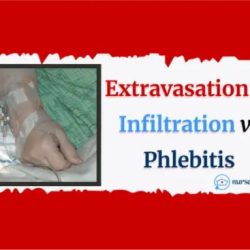 Infiltration extravasation phlebitis infection intravenous access things edgar sec when gov archives data