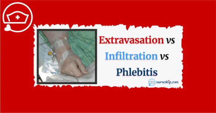 Infiltration extravasation phlebitis infection intravenous access things edgar sec when gov archives data