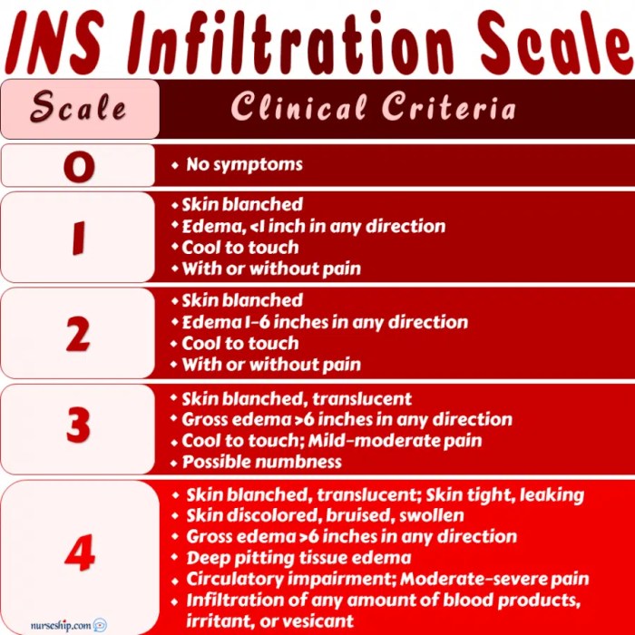 Signs of phlebitis vs infiltration