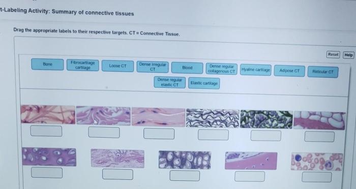 Art-labeling activity an orientation to the tissues of the body